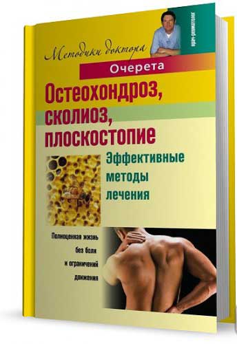 Остеохондроз, сколиоз, плоскостопие. Эффективные методы лечения — А. Очерет