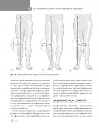 Остеопатическая мануальная медицина в педиатрии (в 2-х томах) — Джейн Каррейро #56