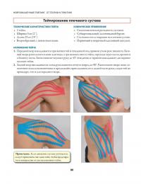 Нейромышечный тейпинг. От теории к практике — Девід Блоу #14